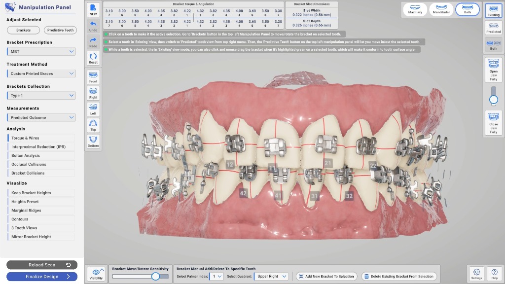 Intelligent Bracket Placement