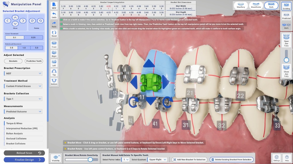 Precision Bracket Adjustment