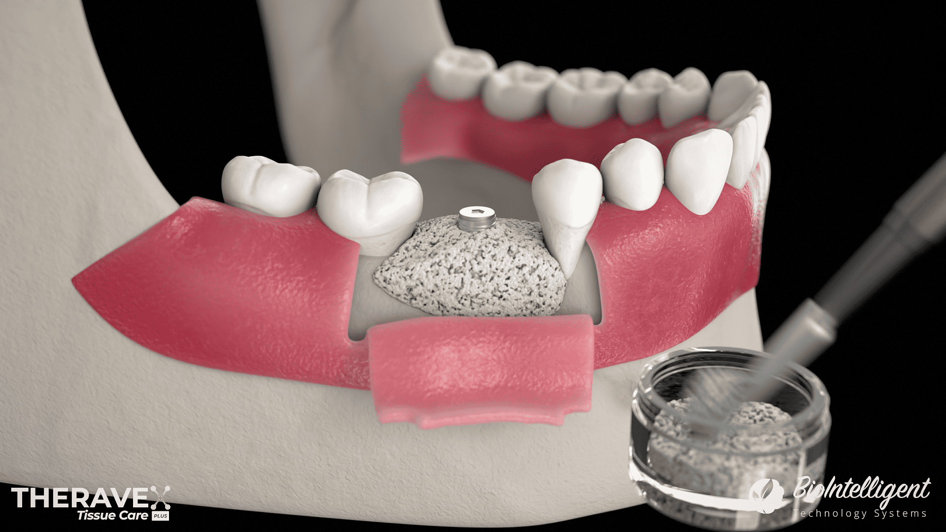 Teeth
